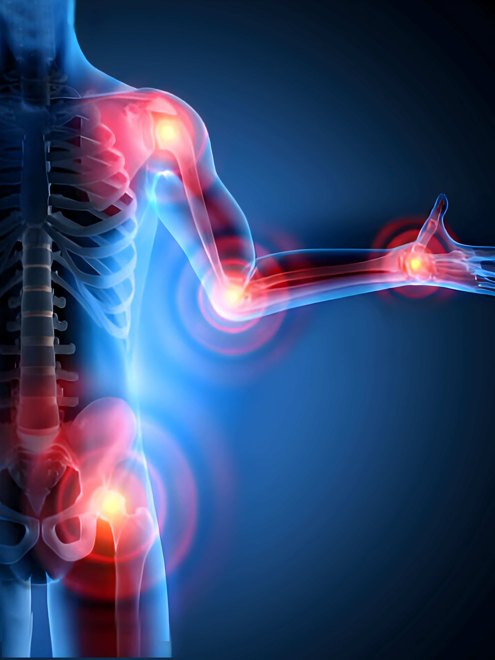 Rheumatology Treatment